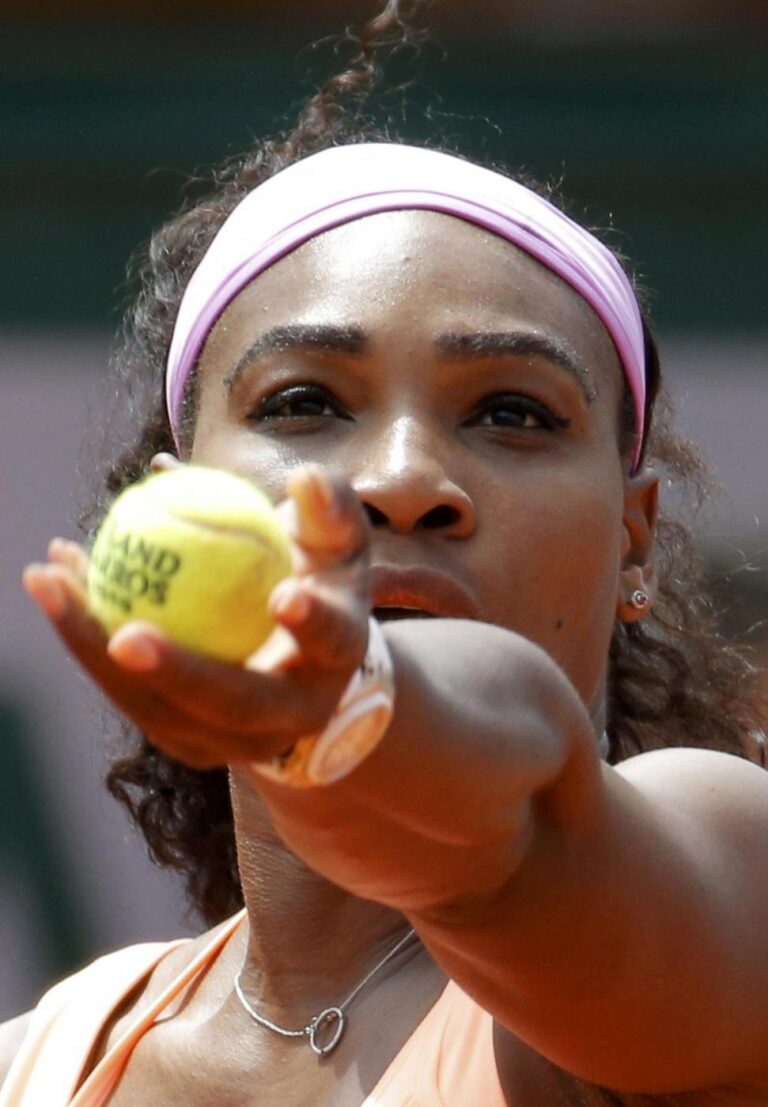 Tennis: Serena Williams col cerotto alla mano per poter indossare il suo  orologio di lusso [FOTO]