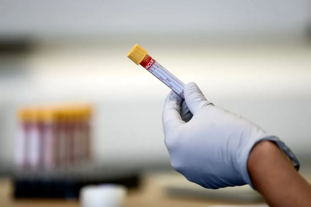 Coronavirus
