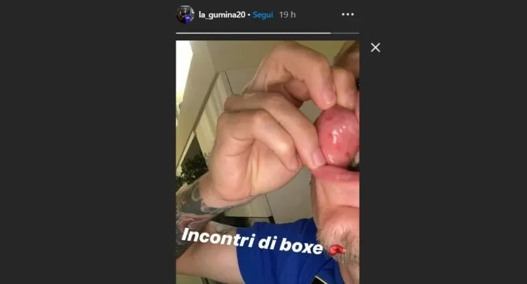 STORIA LA GUMINA