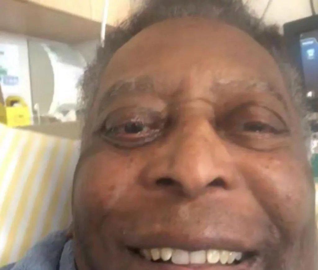 Pelè