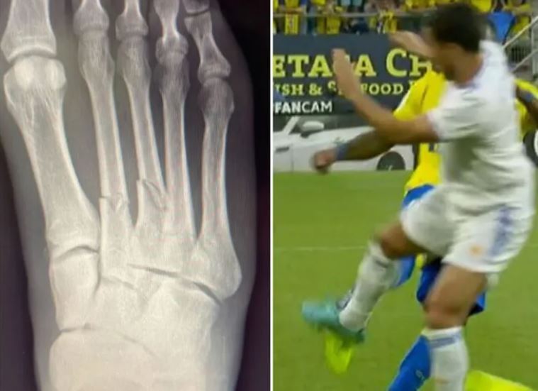Intervento killer di Hazard durante Cadice Real Madrid: Akapo pubblica la FOTO impressionante del piede