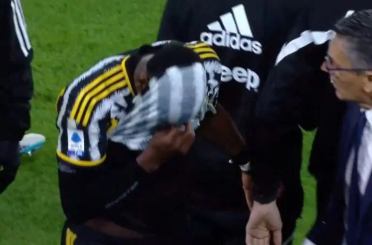 infortunio pogba