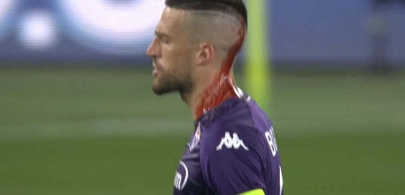 Fiorentina West Ham, lancio di oggetti in campo: Biraghi colpito e sanguinante | VIDEO Fiorentina West Ham, lancio di oggetti in campo: Biraghi colpito e sanguinante | VIDEO